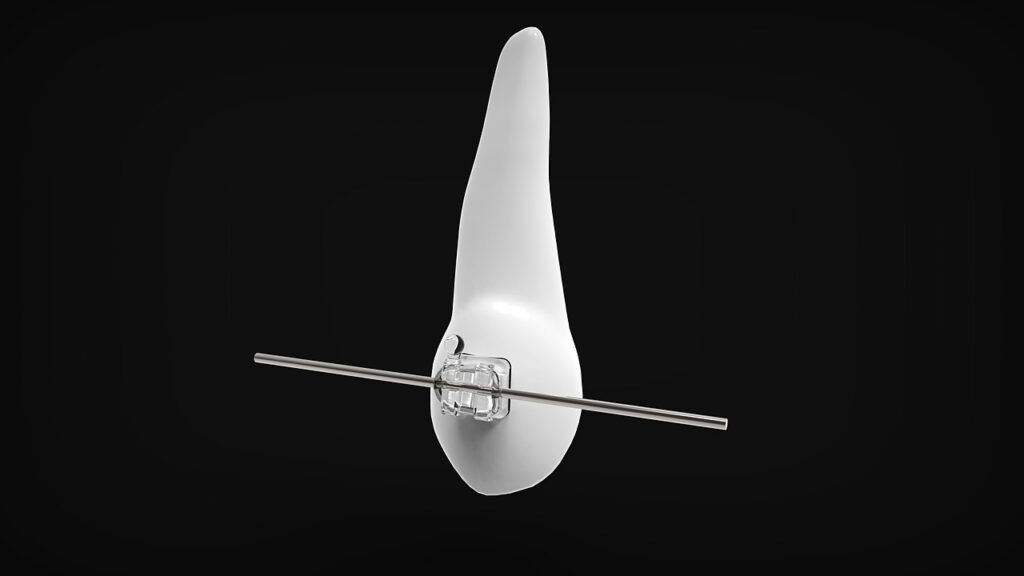 産後の骨盤矯正は痛くない方法で実現できるのか？