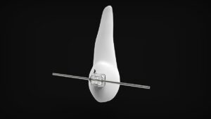 産後の骨盤矯正は痛くない方法で実現できるのか？